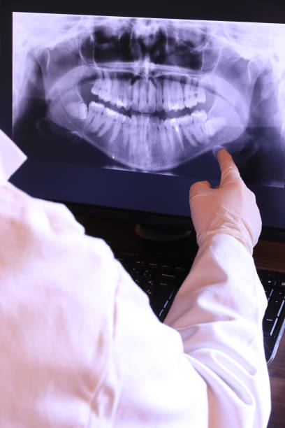 Best Dental Abscess Treatment in Ballinger, TX