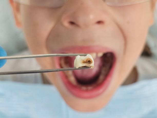 Best Weekend Emergency Dental Services in Ballinger, TX